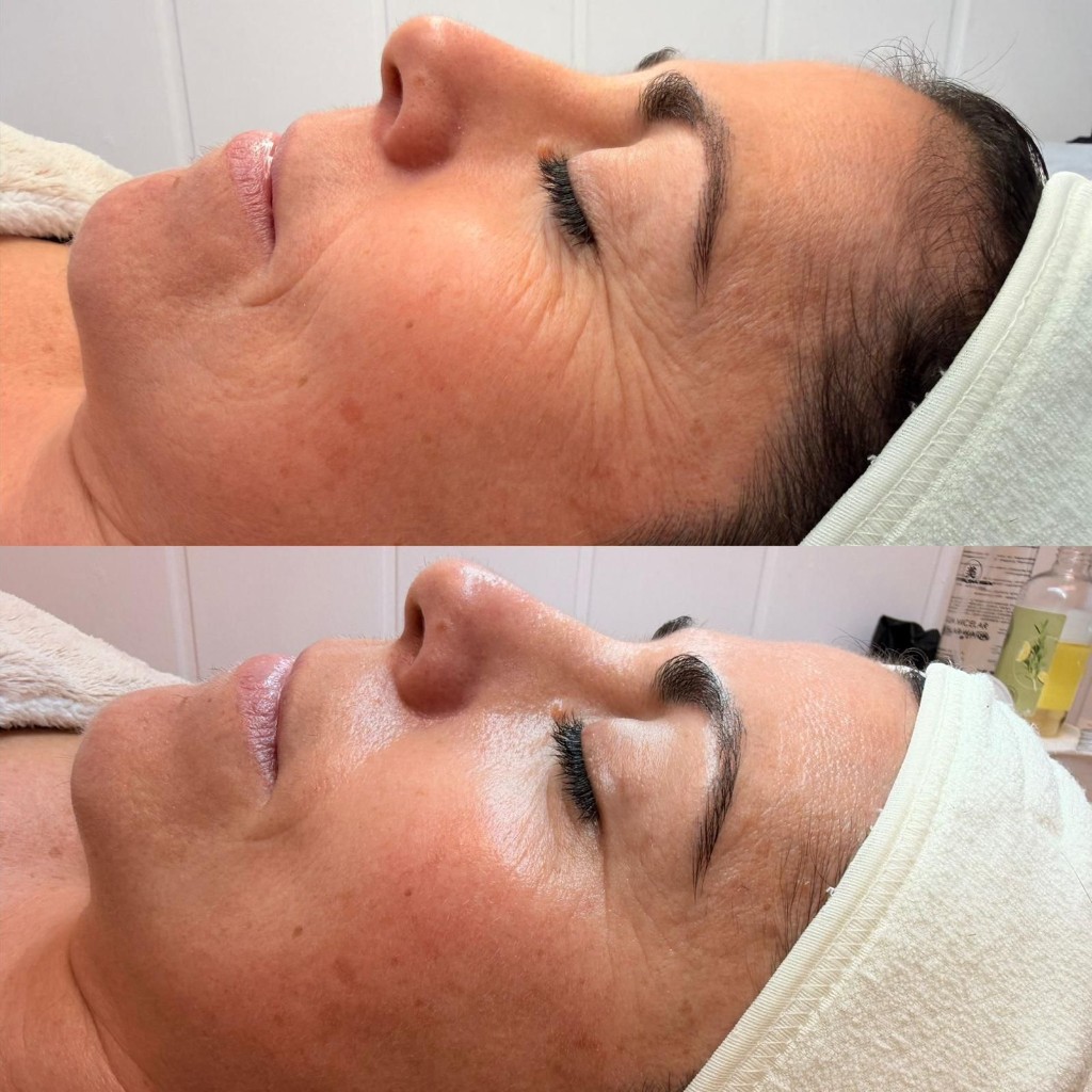 Hidratación facial